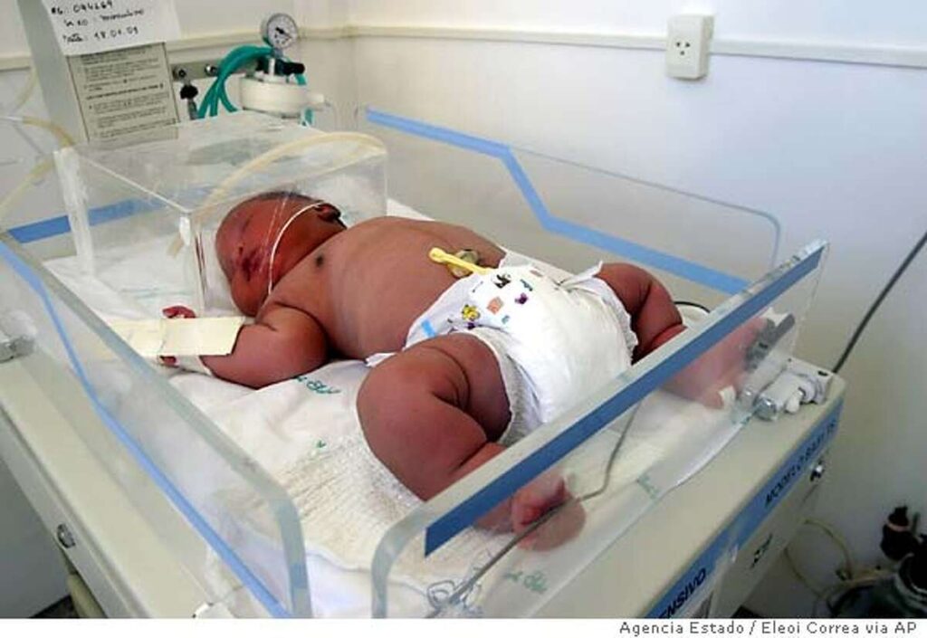 ᐈ 5 найбільших дітей, народжених у світі - великі новонароджені - самі великі 2024