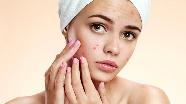 Шкіра - Як правильно лікувати суху шкіру та прищі?